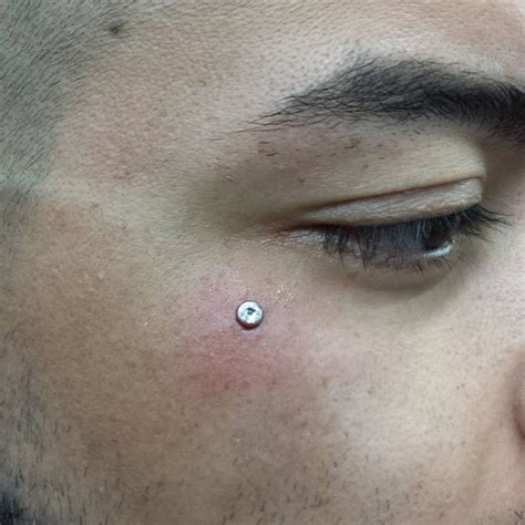 Piercing Microdermal